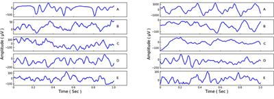 MNL-Network: A Multi-Scale Non-local Network for Epilepsy Detection From EEG Signals